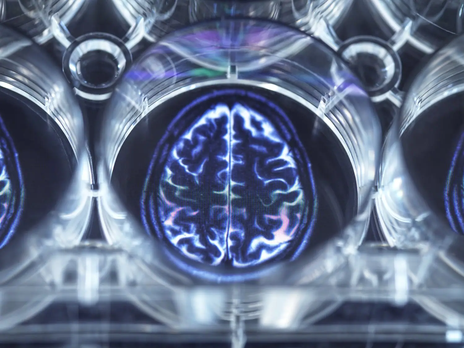 Brain-Computer Interface: przyszłość interakcji człowiek-komputer